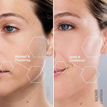 Michael Todd Beauty Sonic-Dermaplaning-Gerät & Augenbrauentrimmer für Damen